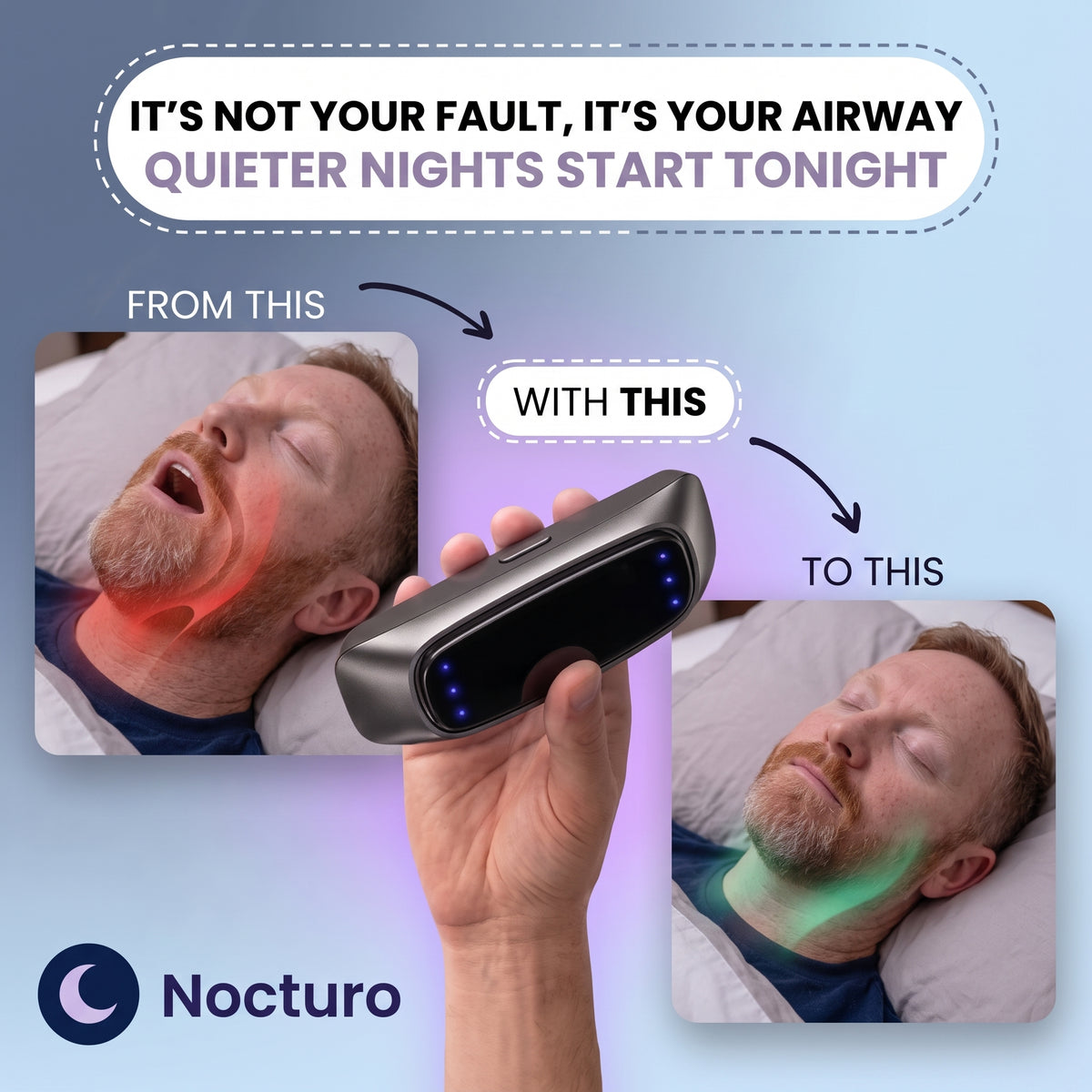 Smart Anti-Snoring Device